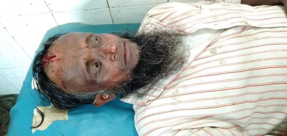 দেবীদ্বারে সাংবাদিকসহ ৩ জনকে কুপিয়ে জখম