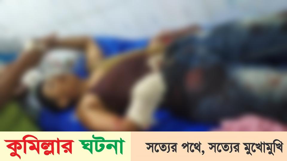 মুরাদনগরে চাচির পরকিয়ার প্রতিবাদ করায় এসএসসি পরিক্ষার্থীর হাত কেটে নিয়েছে চাচাতো ভাই