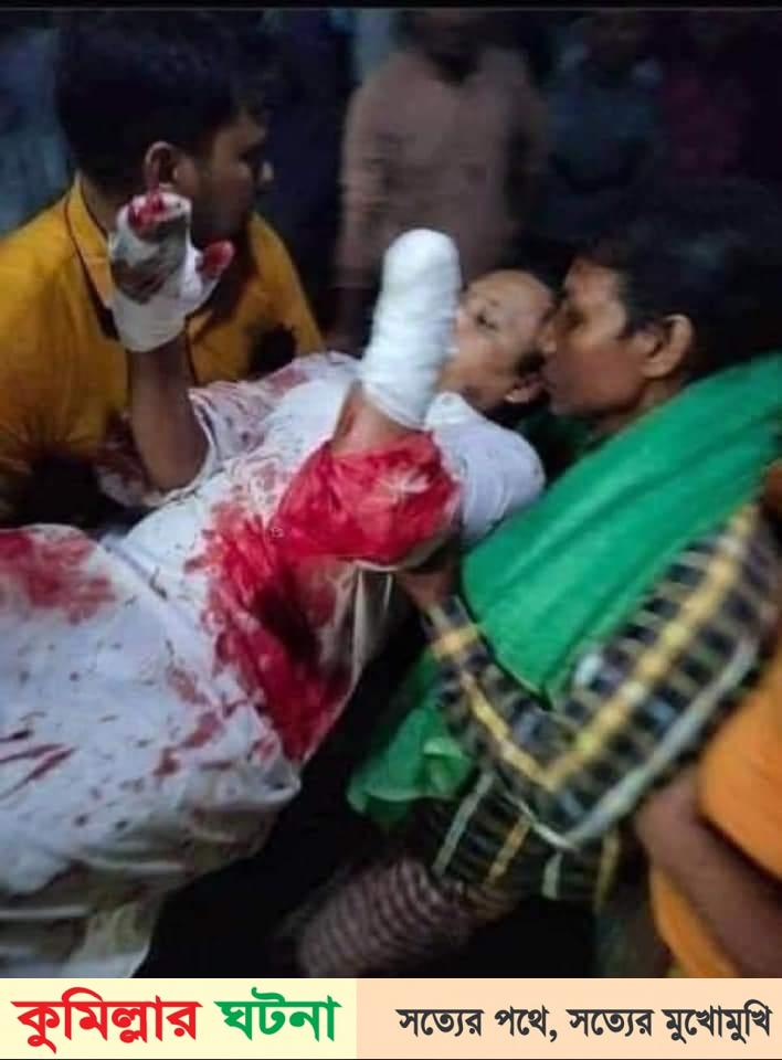 বরিশাল বাবুগঞ্জে ইমামের হাত কেটে নিলো সন্ত্রাসীরা