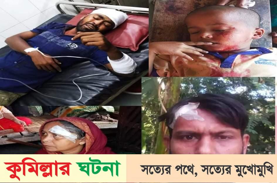 বরুড়ার খোশবাসে স্বতন্ত্র প্রার্থী সমর্থদের হামলায় আহত-৫