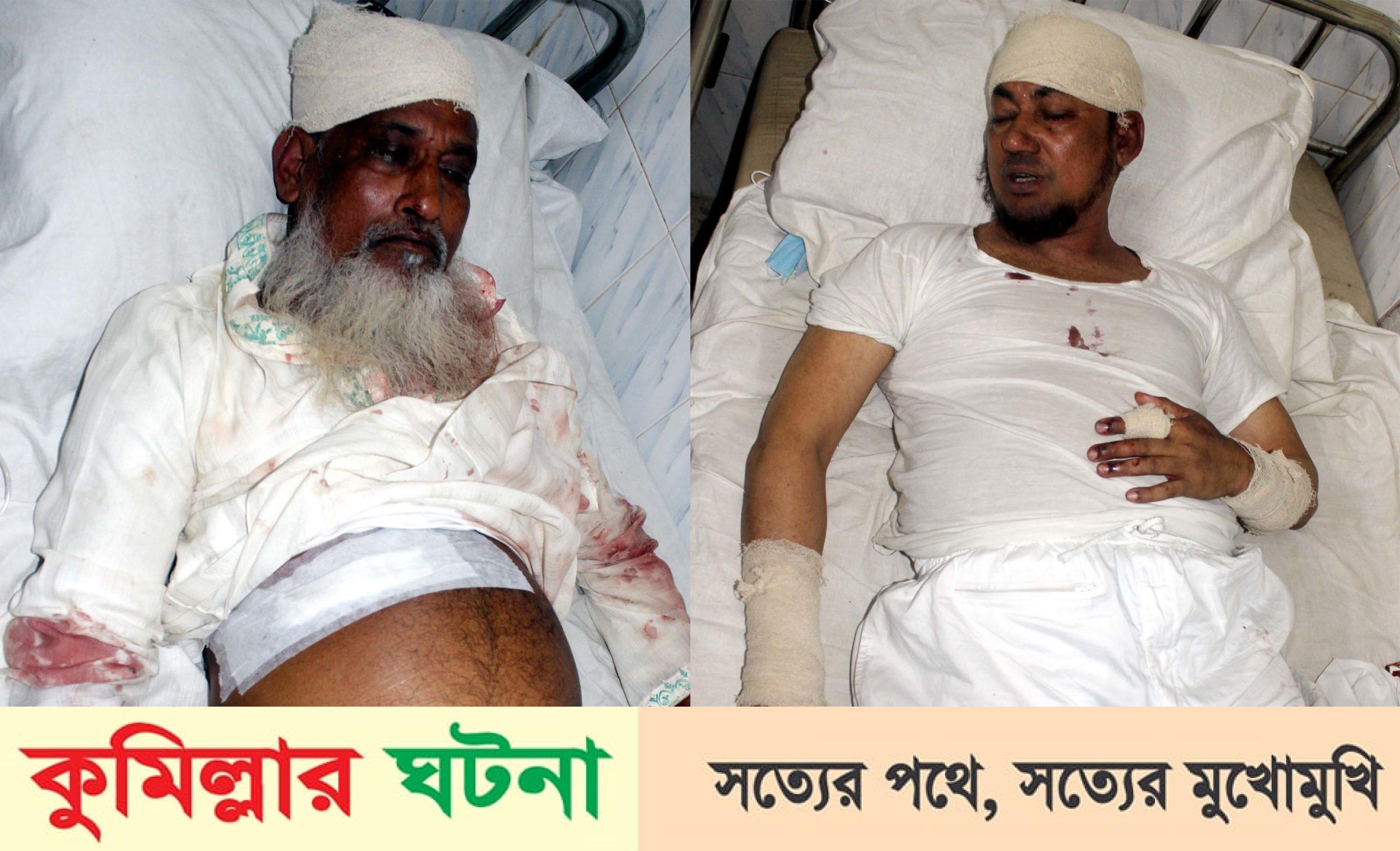 মুরাদনগরে মাদরাসা পরিচালকসহ দু’জনকে কুপিয়ে জখম