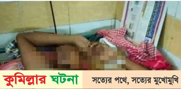 বরুড়ায় ঝগড়া না থামায়:ছুরিকাঘাত,আহত বাবার মৃত্যু