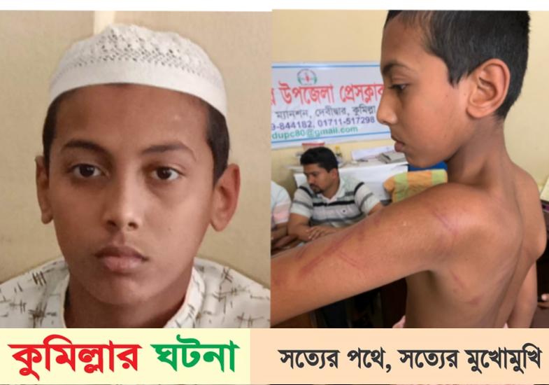 দেবীদ্বারে বড় হুজুর আমার বুকে পাড়া দিয়া ধইরা ২ বেত দিয়া পিটাইছে