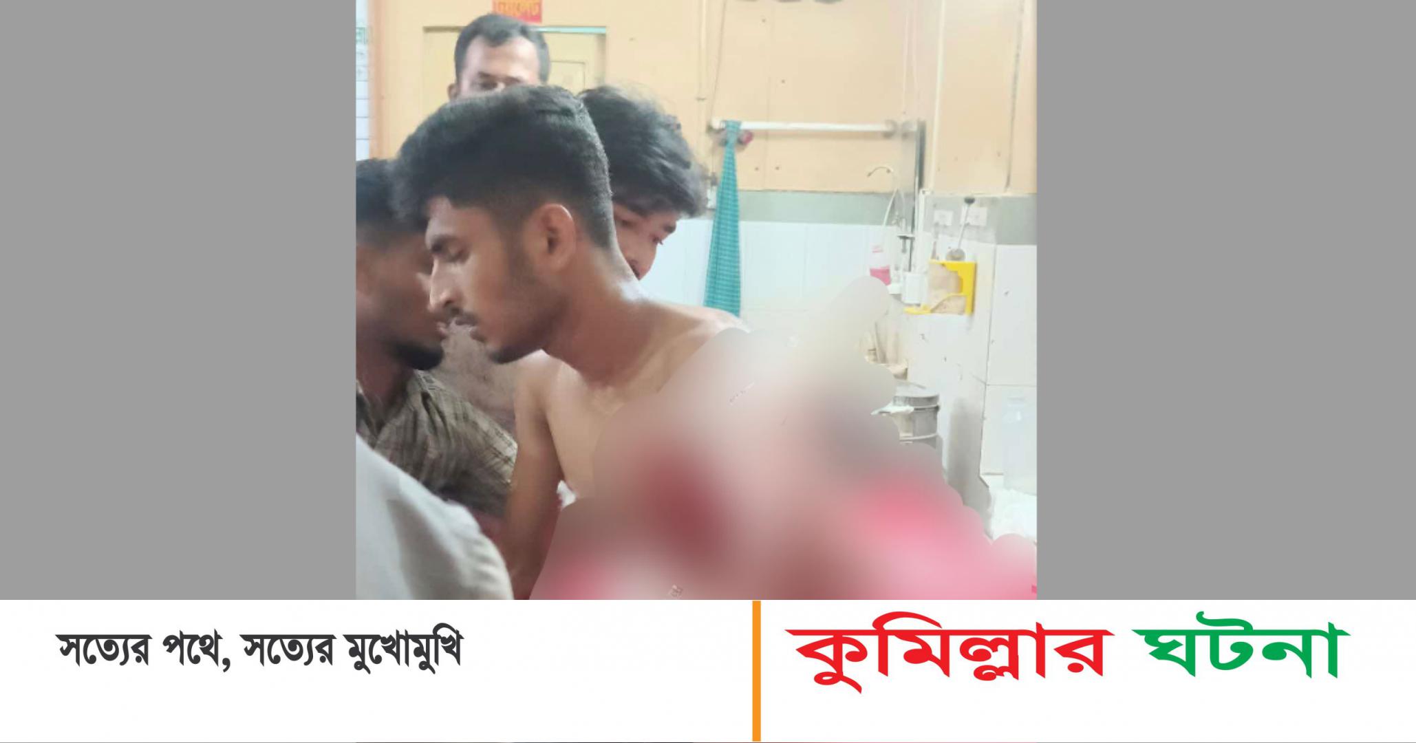 দেবীদ্বারে কিশোরগ্যাং’র চাপাতির উপুর্যপুরি কুপে কিশোর আহত